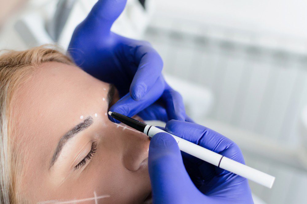 An injector specialist mapping out where to place the Botox injections on a patient.