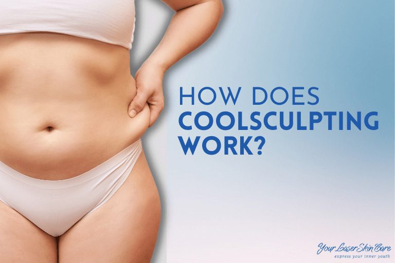 CoolSculpting diagram